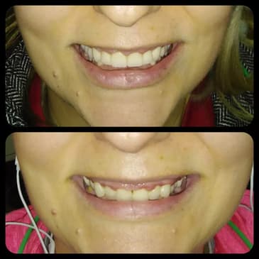 Slider image (5) Dr. Aleksandar Kovacevic - Dental Clinic in Croatia